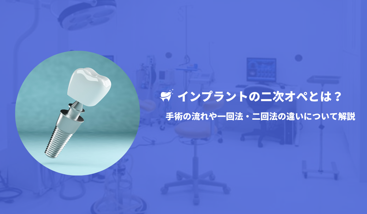 インプラントの二次オペとは？手術の流れや一回法・二回法の違い