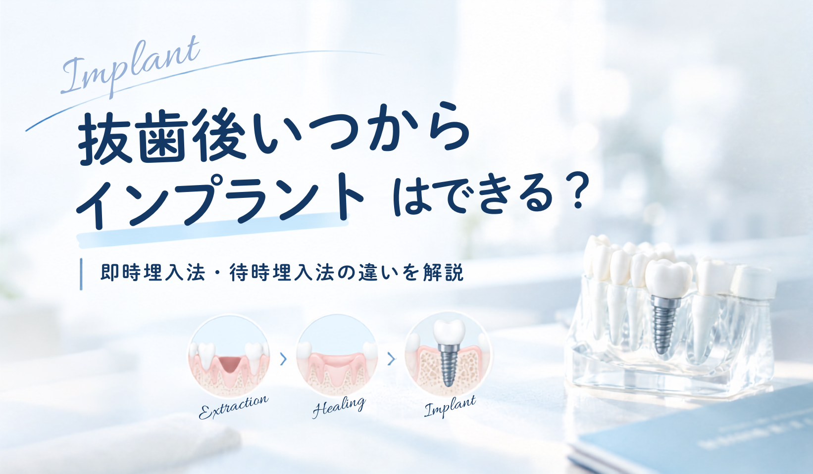 抜歯後いつからインプラントはできる？即時埋入法・待時埋入法の違いを解説